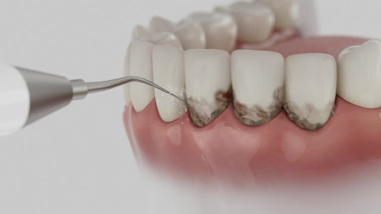 Trusted Root Canal Treatment service in Miami Gardens, FL - Dentist Open Now